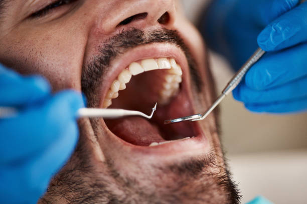 Emergency Dental Services in Brentwood, MD
